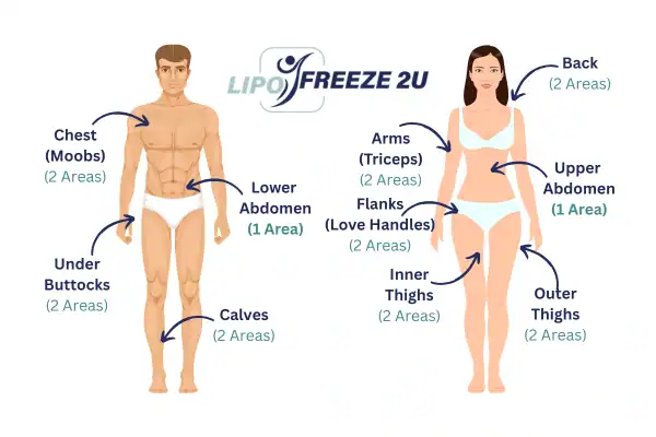 Areas you can have fat freezing treatment Bournemouth