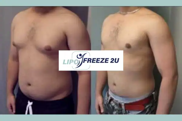How Long Does It Take to See Results Bournemouth?