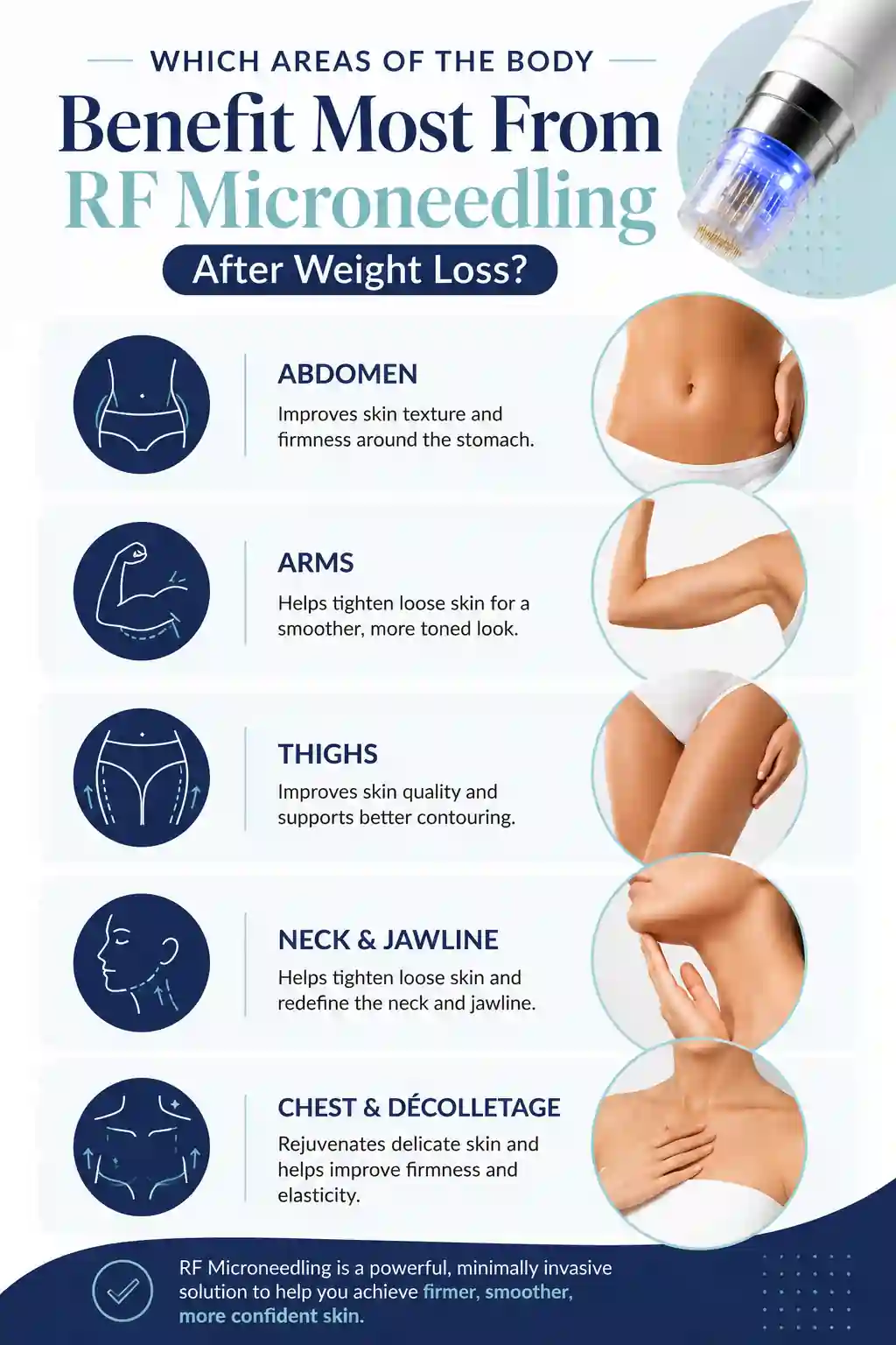 Which Areas of the Body Benefit Most From RF Microneedling After Weight Loss Bournemouth